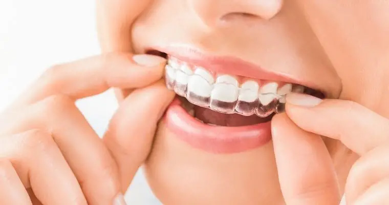 Ceramic Dental Crowns near Modesto