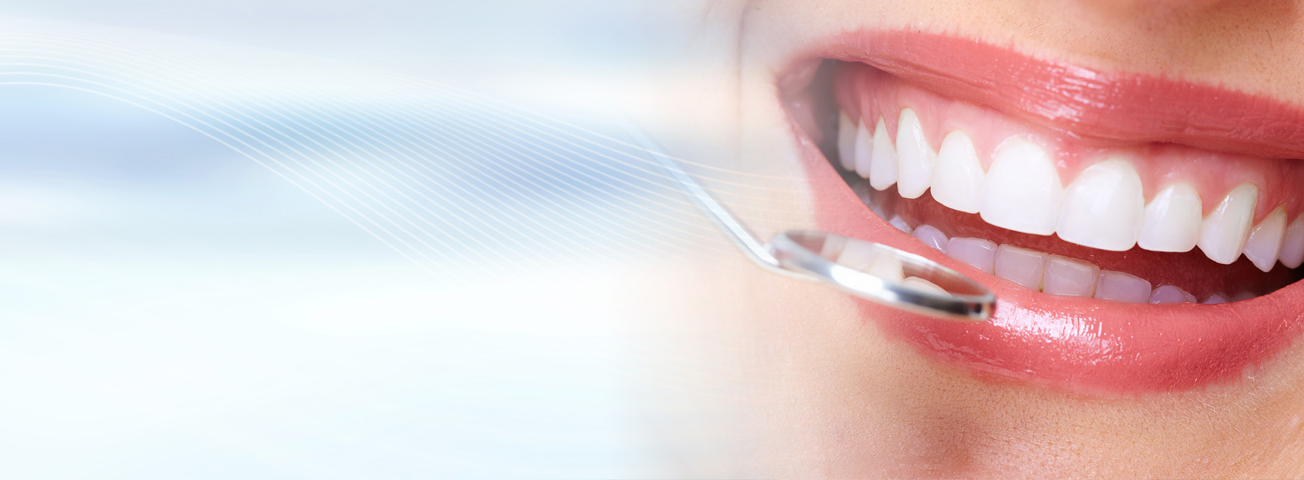 Dental Bonding Modesto