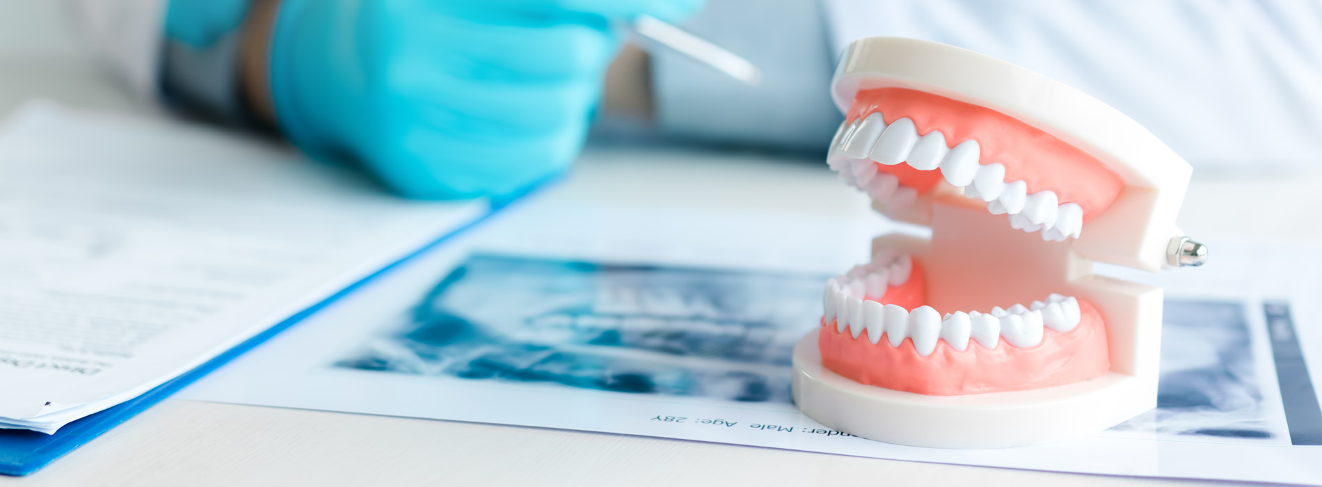 Modesto Implant Supported Dentures