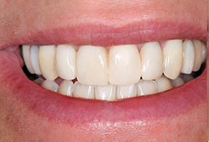 Wayne T. Yee, DDS | Implant-Supported Dentures, Teeth Whitening and Panoramic Imaging