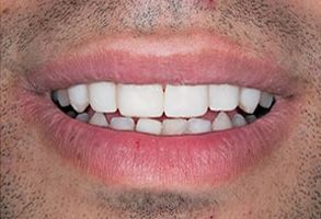 Wayne T. Yee, DDS | Emergency Treatment, Digital Radiography and Veneers