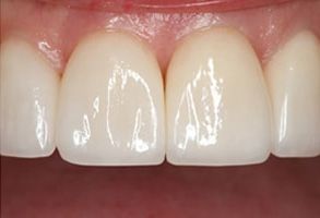 Wayne T. Yee, DDS | Teeth Whitening, Oral Cancer Screening and Intraoral Camera