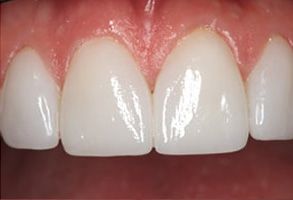 Wayne T. Yee, DDS | Veneers, Periodontal Treatment and Intraoral Camera
