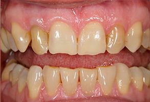 Wayne T. Yee, DDS | Dentures, DIAGNOdent and Periodontal Treatment